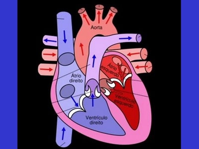 Paciente recebe 1.º coração artificial