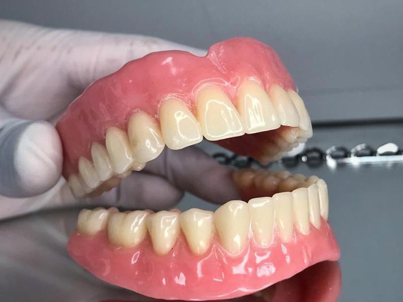 Reabilitação e estética são apenas  alguns dos benefícios das próteses dentárias