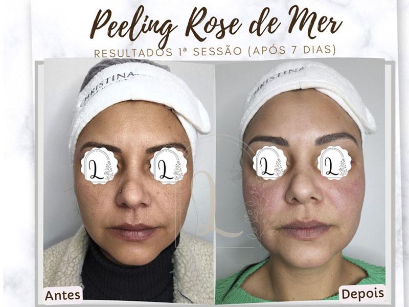 Peeling Rose de Mer – Um Peeling 100% natural 