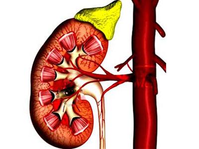 Transplante renal