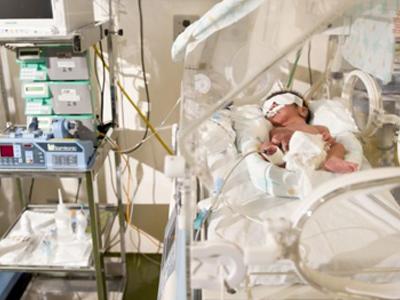 Faltam 3 mil leitos em UTIs neonatais no País