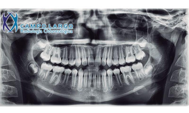 Campo Largo Radiologia Odontológica comemora 15 anos com novidade